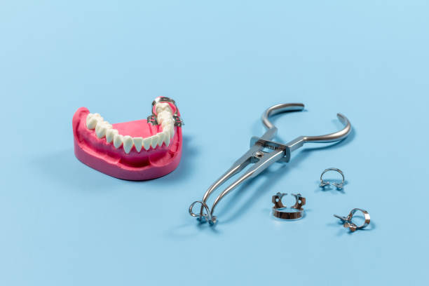 istock Layout of human jaw with rubber dam forceps 1443247340