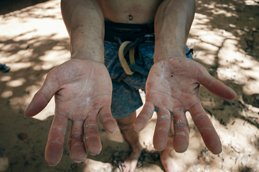 Point of view of a man looking down at his chalked,  battered hands after a long session of rock climbing.