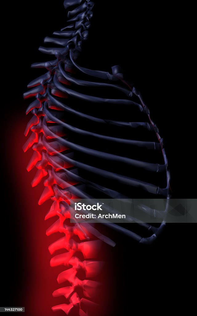 Malessere colonna vertebrale - Foto stock royalty-free di Anatomia umana
