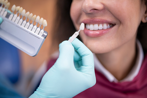 Dentist uses a palette tooth color sample to determine shade of patient's teeth.
