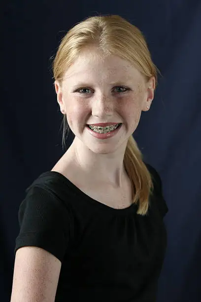 girl with braces smiling into the camera.  photographed against a dark background.