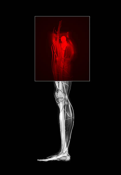 엉덩관절 통증 (xxl - x ray human knee orthopedic equipment human bone 뉴스 사진 이미지
