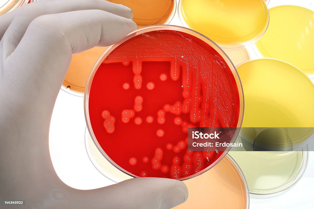 Placas de Petri para la investigación médica - Foto de stock de Analizar libre de derechos