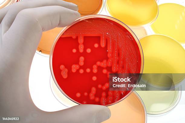 Placas De Petri Para La Investigación Médica Foto de stock y más banco de imágenes de Analizar - Analizar, Asistencia sanitaria y medicina, Bacteria