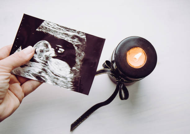 Conceptual image of woman mourning, miscarriage. Mother hand holding ultrasound picture of baby. Black candle with black ribbon burning. stock photo