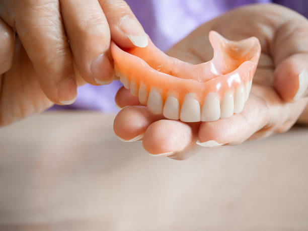 close up of hands of  elderly woman holding a denture. - dentures imagens e fotografias de stock