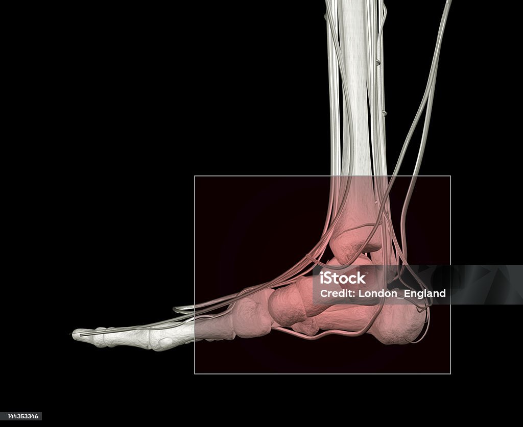 アンクルの痛み - X線撮影のロイヤリティフリーストックフォト