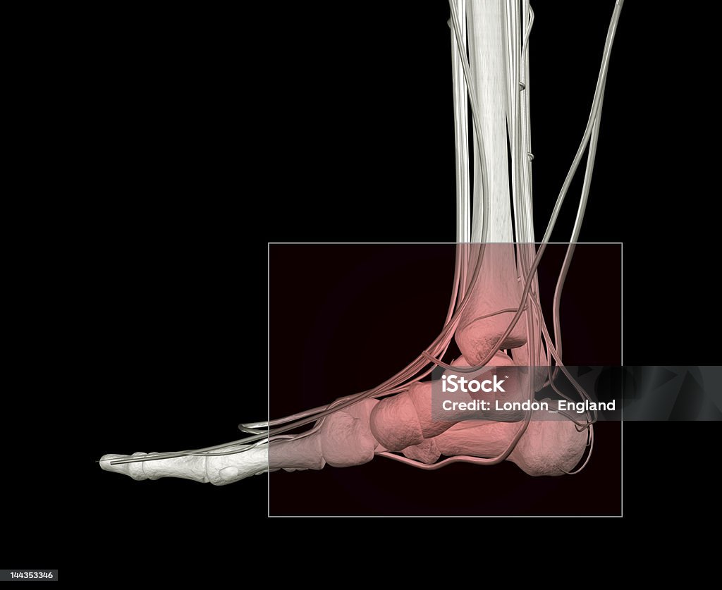 발목 통증 - 로열티 프리 X-레이 스톡 사진