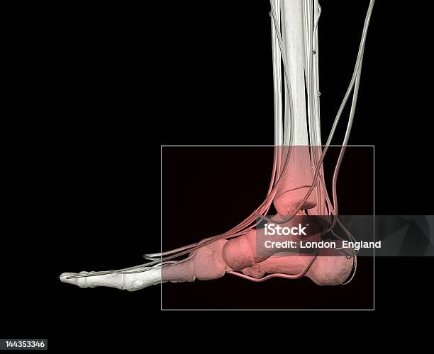 발목 통증 X-레이에 대한 스톡 사진 및 기타 이미지 - X-레이, 건강관리와 의술, 건강한 생활방식