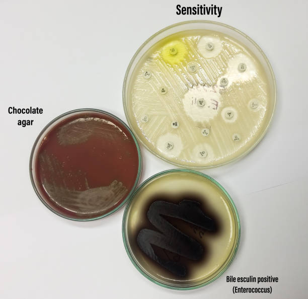 Antimicrobial susceptibility testing in culture plate. Drug sensitivity test, chokolate plate pure growth of Enterococcus bacteria. Positive in bile esculin agar plate,selective media for Enterococci. prueba de sensibilidad antimicrobiana en placa de cultivo. prueba de sensibilidad a medicamentos, crecimiento puro de placa de chokolato de bacterias enterococcus. positivo en placa de agar esculina biliar, medios selectivos para enterococos.