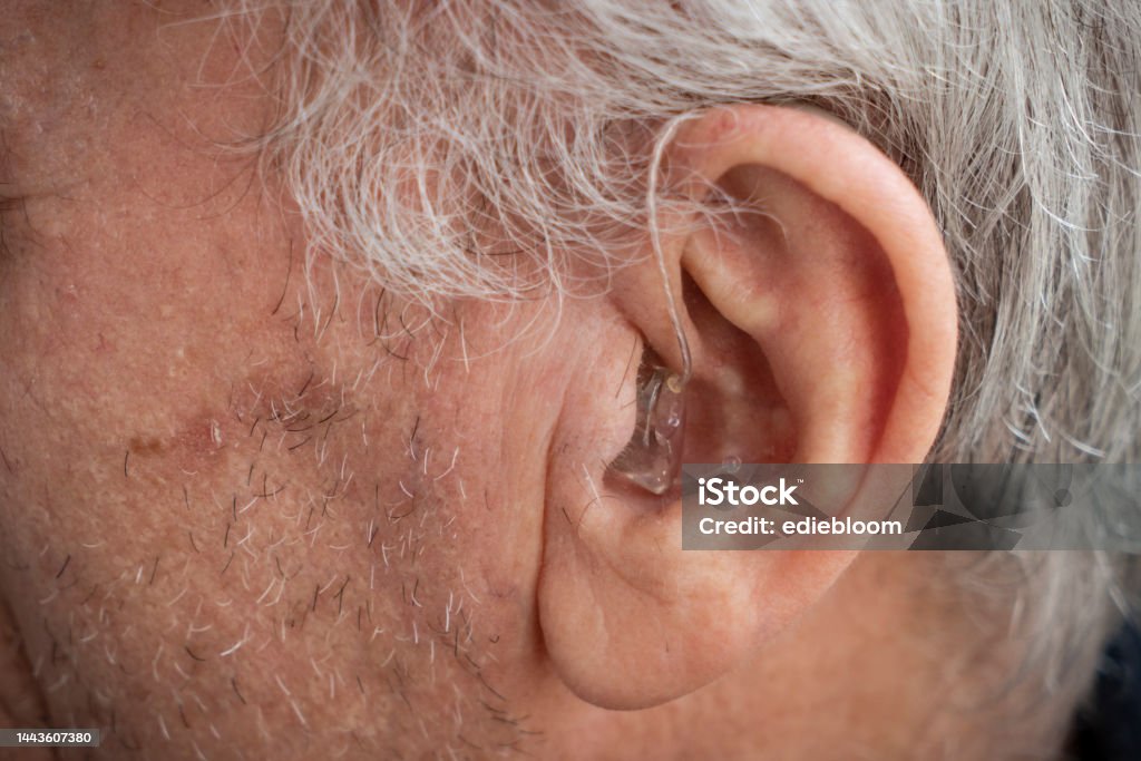 Hearing aid placed in the ear of an elderly person Ear Stock Photo