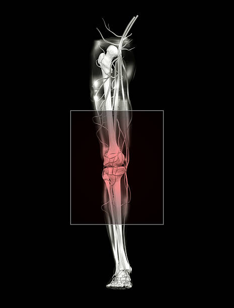 Cтоковое фото Боль в ногах