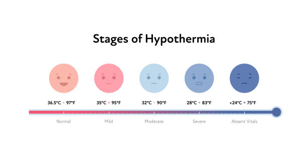 ilustrações de stock, clip art, desenhos animados e ícones de frostbite and hypothermia health care infographic collection. vector flat healthcare illustration. red and blue human face smile avatar icon. body temperature for stages. celsius and fahrenheit symbol - congelação