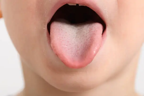 Photo of Studio shot of little boy's face, sticking out tongue