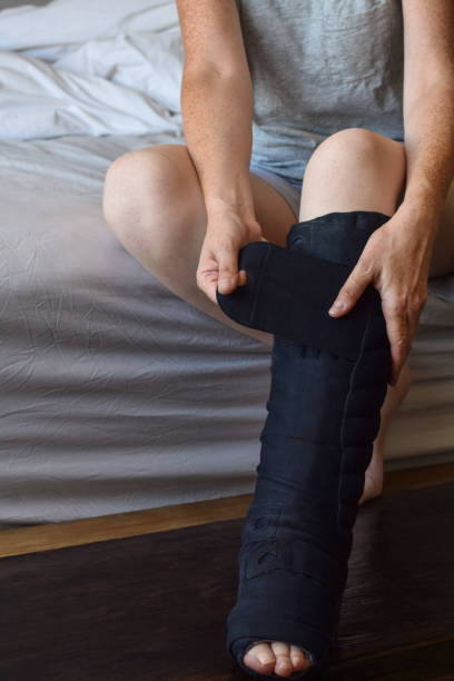istock Woman putting on night compression wrap on lymphedema affected leg 1443971674