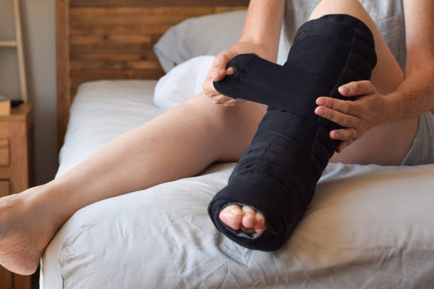 istock Woman putting on night compression wrap on lymphedema affected leg 1443971690