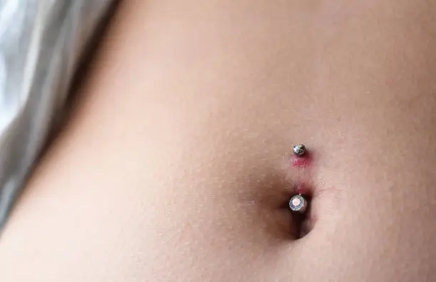 Closeup on teenage girl belly button piercing infection