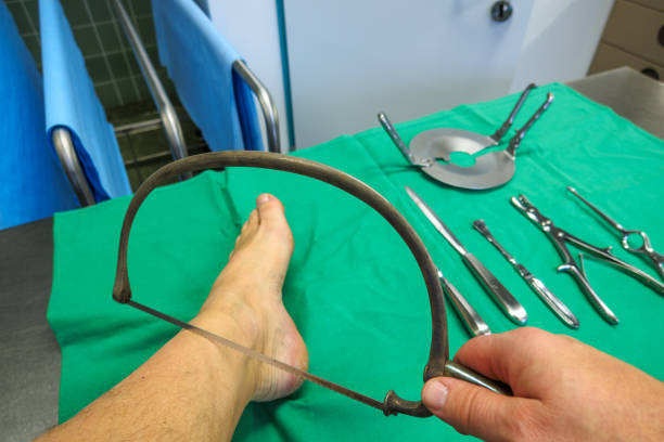 an amputation saw is applied to one leg in an operating room
