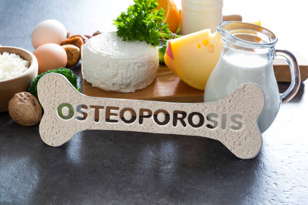 Osteoporosis concept Osteoporosis concept. Food products recommended for osteoporosis, diary and non-diary products rich in calcium. osteoporosis stock pictures, royalty-free photos & images