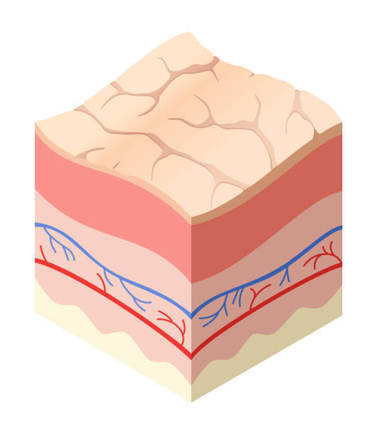 istock Skincare medical concept. Problems in cross-section of human skin horizontal layers structure. Anatomy illustrative model unhealthly layer of skin 1444166579