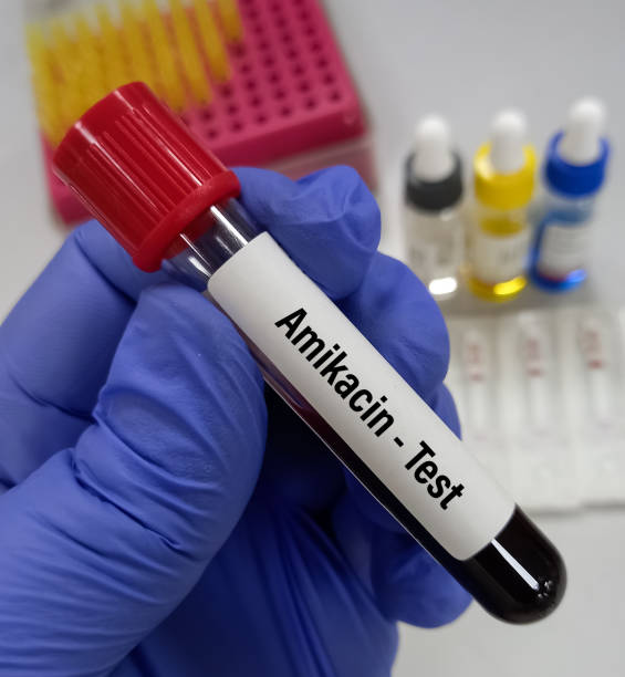 istock Hand hold blood sample for Amikacin level test with laboratory background. 1444449806