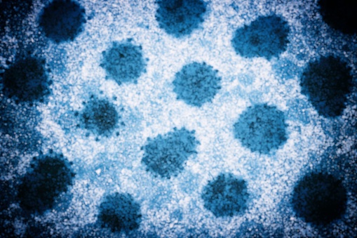 Abstract Blurred View of Coronavirus Outbreak Concept Background.