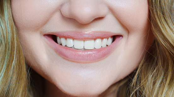 close-up. a woman's smile with bleached white teeth. the concept of professional cleaning and whitening of teeth or ceramic veneers. processing of teeth in the photo editor.