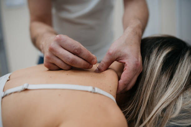 istock Woman having an acupuncture treatment on her back 1444823637