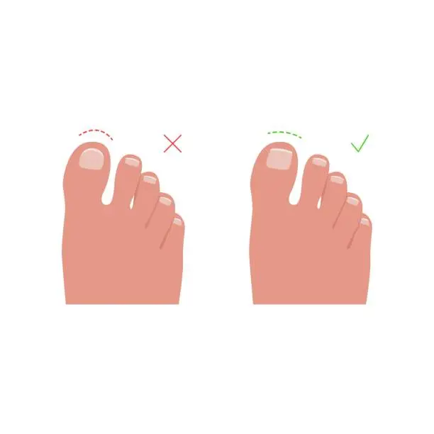 Vector illustration of Toe nails cutting vector illustration