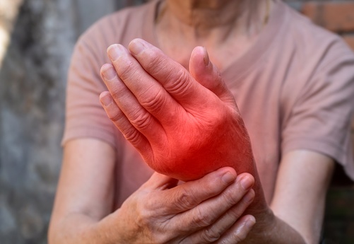 Inflamación de las articulaciones de la mano. Concepto de artritis reumática, reumatismo, gota, hinchazón articular o artralgia. photo