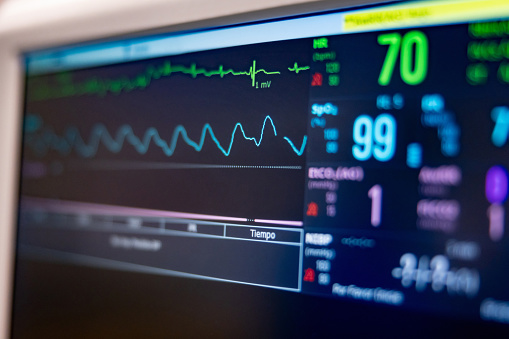 Close-up on a monitor at the hospital monitoring a patient's vitals - healthcare and medicine concepts