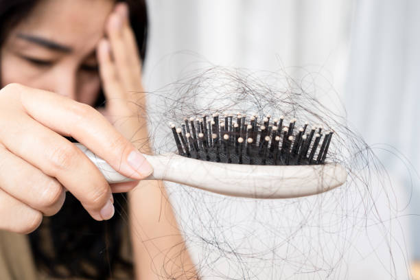 Asian woman have a problem with hair loss after brushing  holding a comb with hair fall stock photo