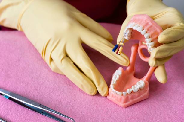 istock Closeup of a dentist practicing on a model of prosthetic teeth with dental tools 1445657741