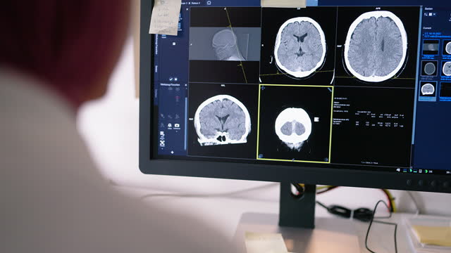 Doctor examining CT scan images on computer screen in control room
