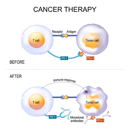 Cancer therapy of monoclonal antibodies. treatment of endometrial cancer, Hodgkin lymphoma, carcinoma, breast and lung tumor. Antibody binds to the PD-1 receptor and block its activity, that prevent tumor cells from bypassing immune response. Vector diagram about a new cancer drug with 100% success rate