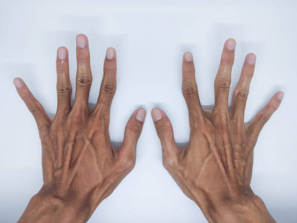 istock skinny man hand on isolated background 1445741513