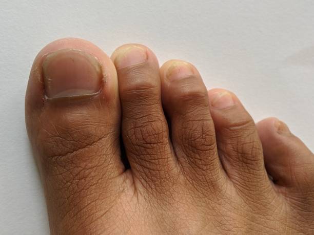 istock Close-up of toe texture on isolated background 1445742671