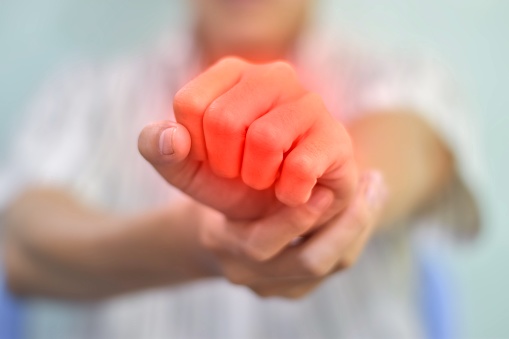 Inflamación de las articulaciones de la mano. Concepto de artritis reumática, hinchazón articular, gota o artralgia. photo