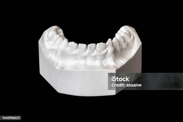 Plaster Cast Of A Denture Bite Of A 13 Year Old Person For Medical Examination Stock Photo - Download Image Now