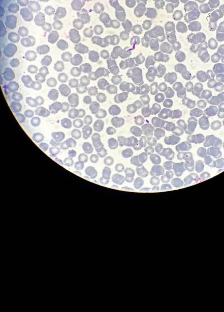 trypanosoma-parasit im menschlichen blut. labordiagnose. - eukaryot stock-fotos und bilder