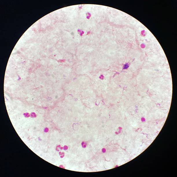 parasitas de trypanosoma no sangue humano. exame de diagnóstico laboratorial para tripanossomíase. - doença de chagas - fotografias e filmes do acervo