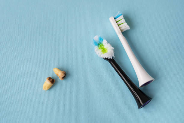 istock A modern electric toothbrush on a blue background next to extracted wisdom teeth affected by caries. Tooth extraction operation. Hygiene concept for daily care. Old and new toothbrush. 1446235212