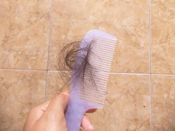 istock hair loss on the comb 1446285609