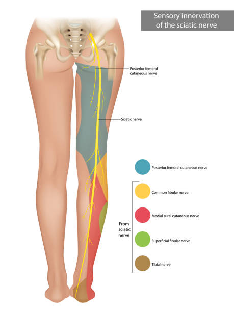 illustrations, cliparts, dessins animés et icônes de le nerf sciatique. innervation sensorielle du nerf sciatique. sciatique. - spinal nerve