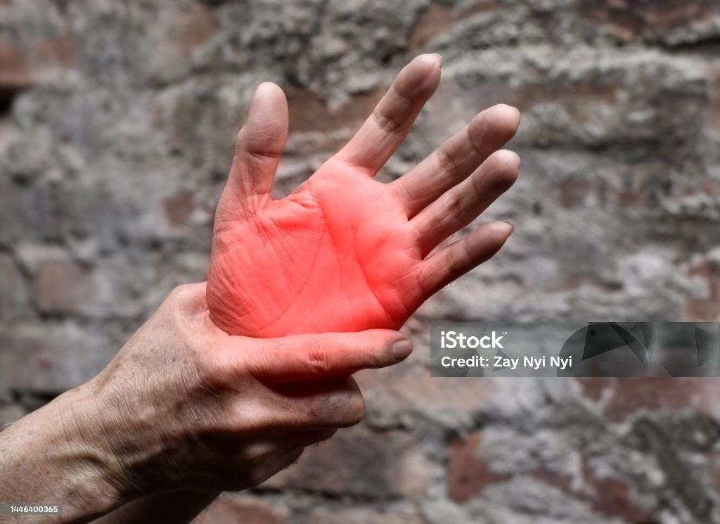 Painful palm of Asian man. Concept of compartment syndrome, cellulitis and hand muscles pain. Painful palmar aspect of Asian old man. Concept of compartment syndrome, cellulitis and hand muscles pain. Adult Stock Photo