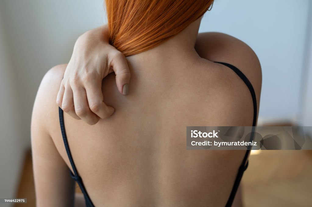 Woman with skin problem Skin Stock Photo
