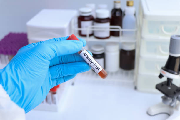 istock Allergy test to look for abnormalities from blood 1446484961