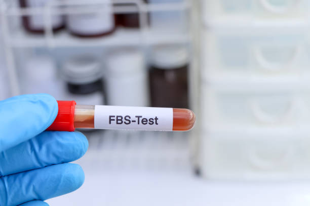 istock FBS test to look for abnormalities from blood 1446485020