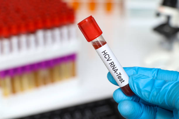 istock HCV RNA Test to look for abnormalities from blood 1446488371