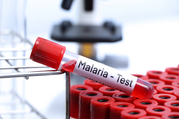 malaria test to look for abnormalities from blood - malaria imagens e fotografias de stock